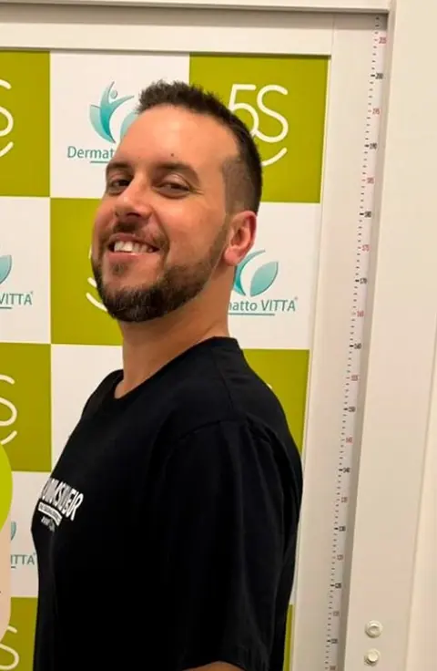 Gustavo depois de eliminar 70 kg: de perfil