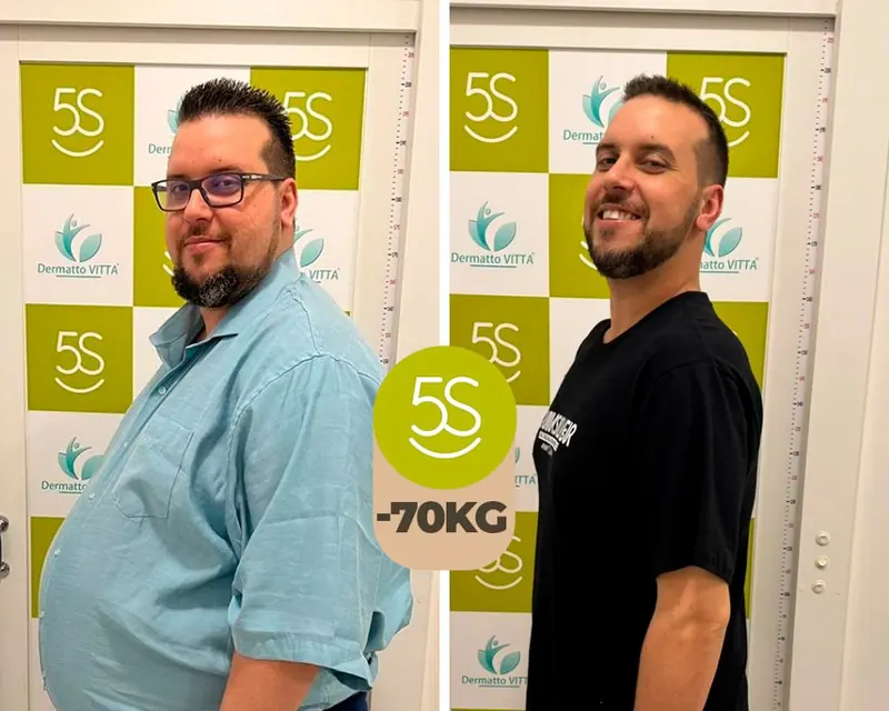 Gustavo de perfil, antes e depois de eliminar 70 kg